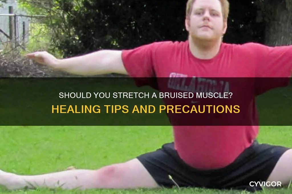 is it good to stretch a bruised muscle