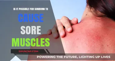Sunburn and Sore Muscles: Is There a Connection?