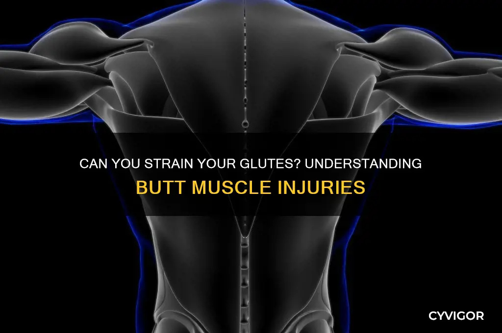 Can You Strain Your Glutes? Understanding Butt Muscle Injuries | CyVigor