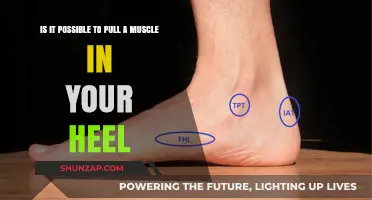 Can You Strain Your Heel Muscle? Causes and Prevention Tips