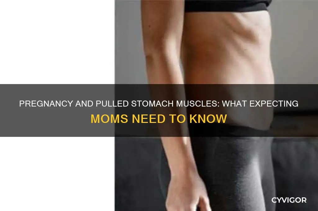 is it possible to pull a stomach muscle when pregnant