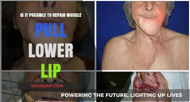 Can You Repair a Pulled Lower Lip Muscle? Expert Insights