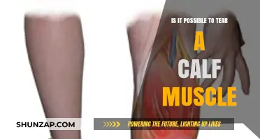 Understanding Calf Muscle Tears: Causes, Symptoms, and Recovery