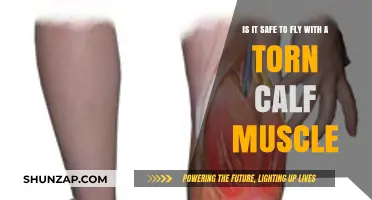 Flying with a Torn Calf Muscle: What You Need to Know