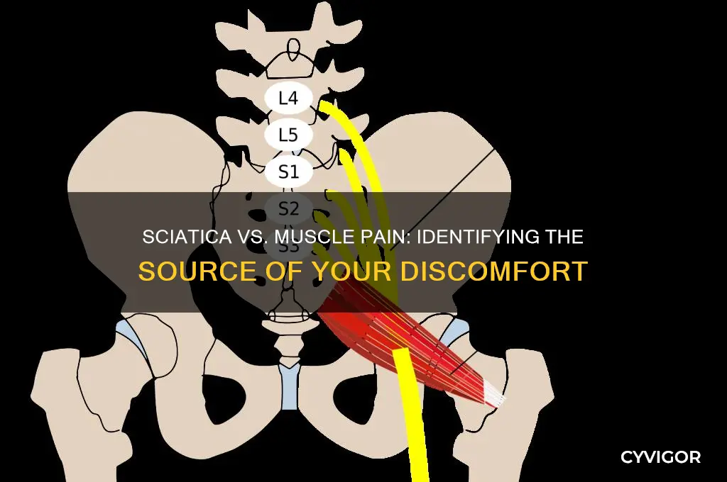 is it sciatica or muscle pain