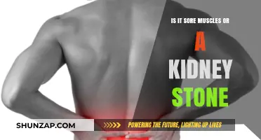 Sore Muscles or Kidney Stone: How to Tell the Difference