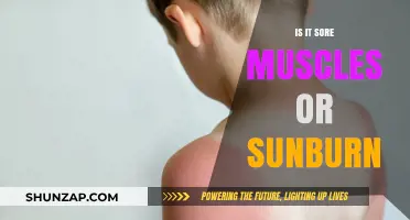 Sore Muscles or Sunburn: How to Tell the Difference