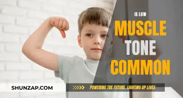 Muscle Tone and You: Is Low Tone Common?