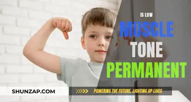 Muscle Tone and Flexibility: Can Low Tone Be Reversed?