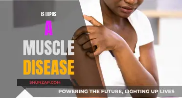 Lupus and Muscles: Understanding the Complex Connection