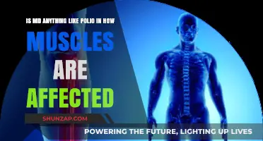 Muscular Dystrophy vs. Polio: Similarities in Muscle Impact Explained
