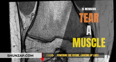 Meniscus Tears: Muscle or Cartilage?