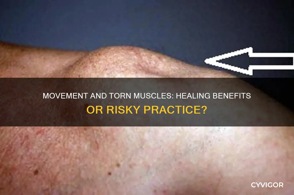 is movement good for a tore muscle