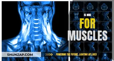 MRI for Muscle Health: What You Need to Know