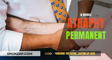 Muscle Atrophy: Can It Be Reversed?