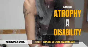 Muscle Atrophy: Understanding Its Impact and Disability Status
