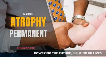 Muscle Atrophy: Can It Be Reversed or Not?