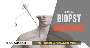 Muscle Biopsy: Is It Safe or Risky?