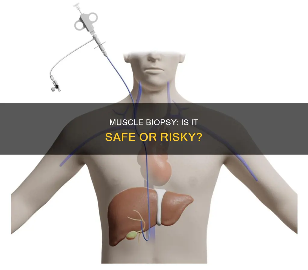 is muscle biopsy dangerous