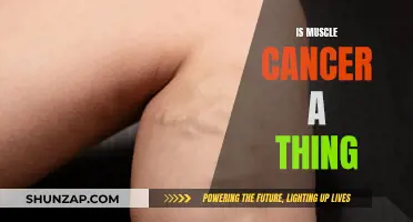 Muscle Cancer: A Rare but Real Threat