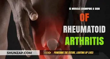 Could Your Muscle Cramps Be a Sign of Rheumatoid Arthritis?