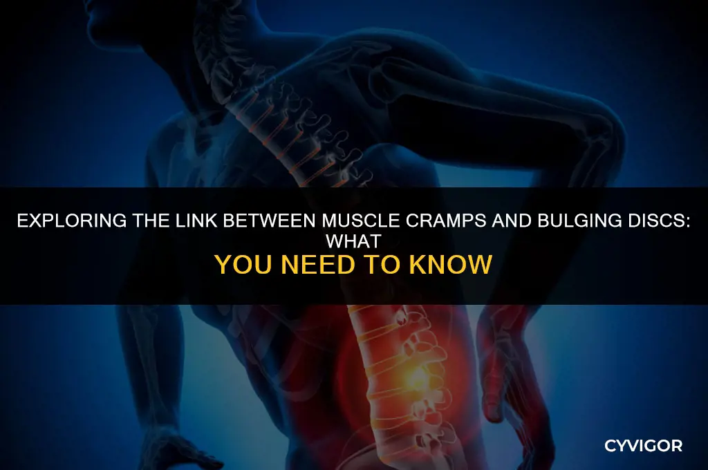 is muscle cramps associated with bulging disc
