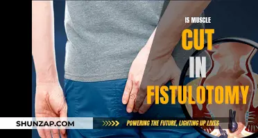 Fistulotomy: Does It Cut Through Muscle?