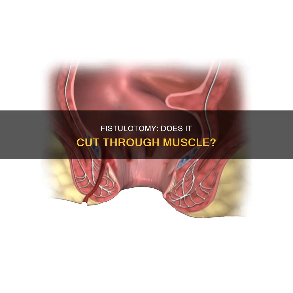 is muscle cut in fistulotomy