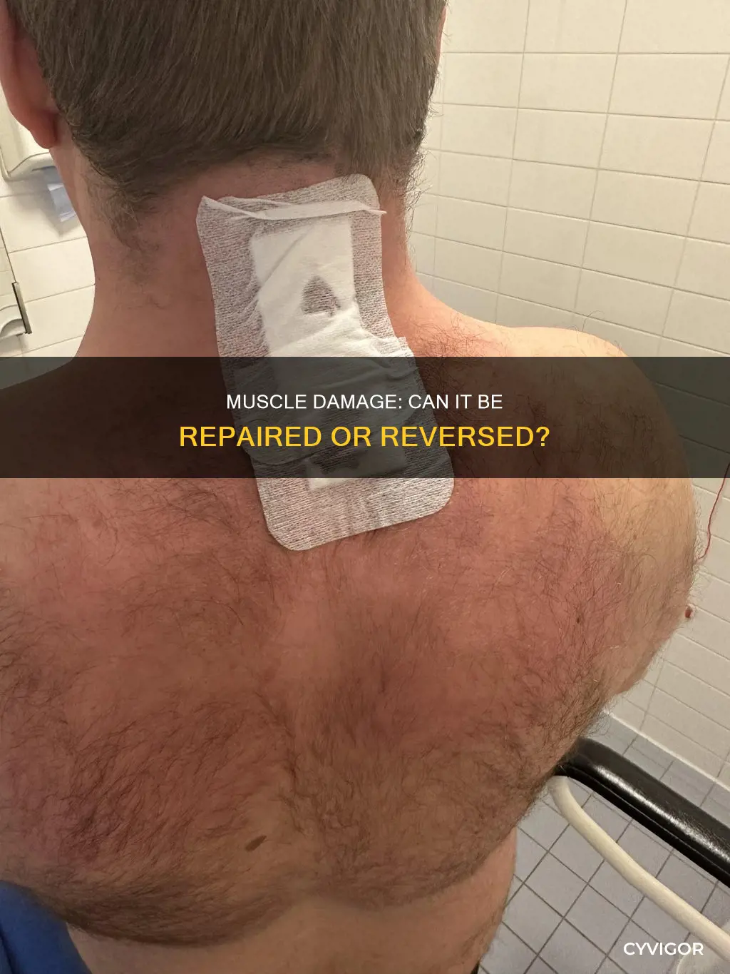 is muscle damage permanent