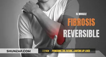 Muscle Fibrosis: Reversing the Damage and Restoring Function