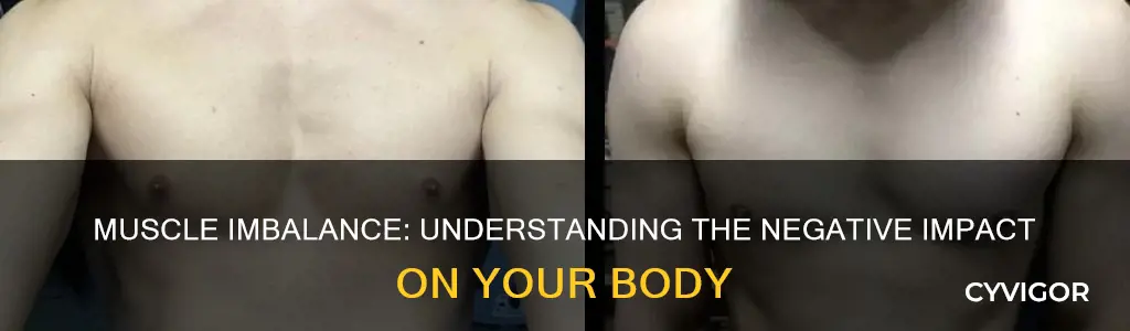 is muscle imbalance bad