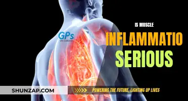 Muscle Inflammation: Is It a Serious Health Concern?