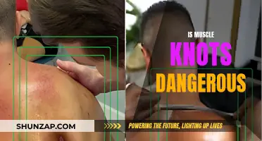 Muscle Knots: Are They Dangerous and Harmful?