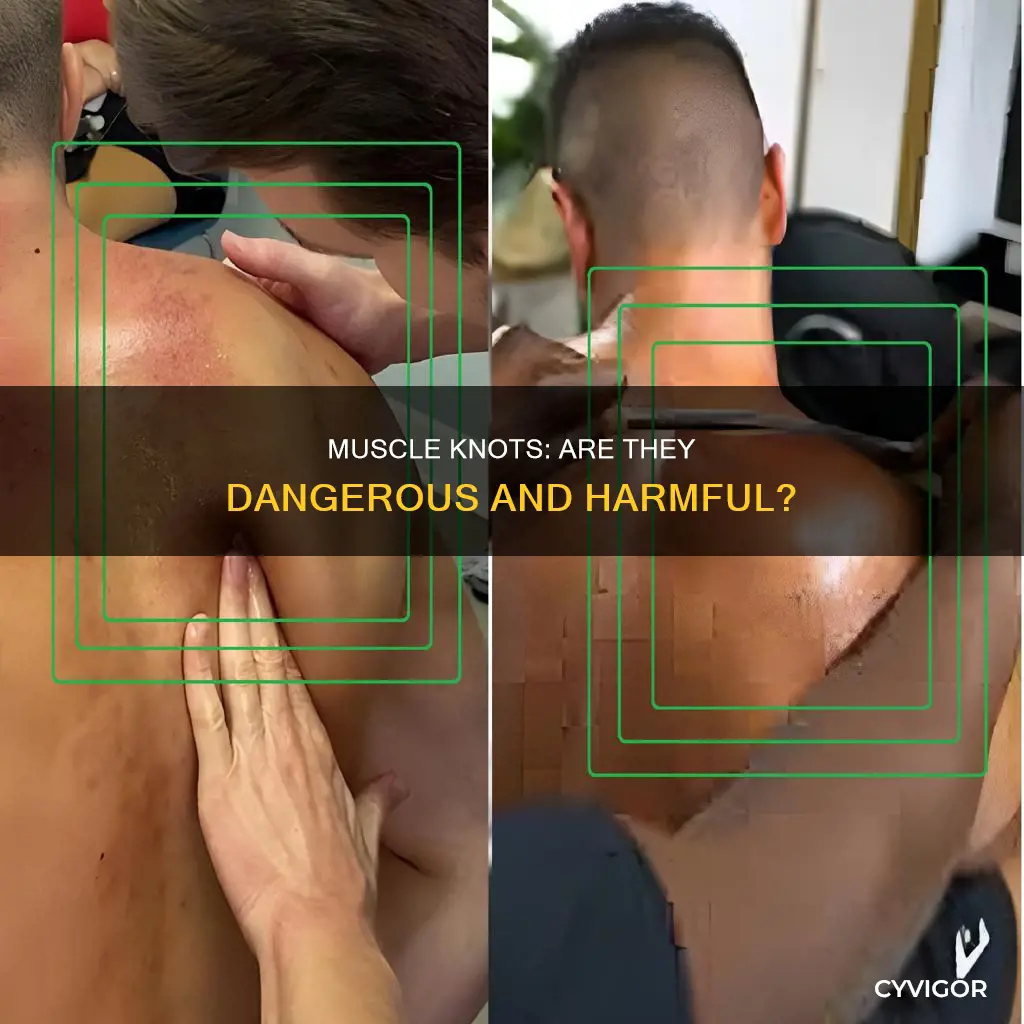 is muscle knots dangerous