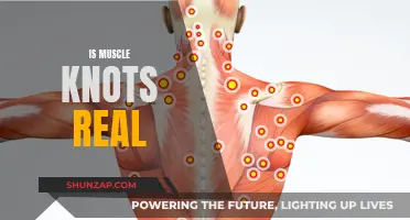 Muscle Knots: Understanding the Reality of These Painful Tangles