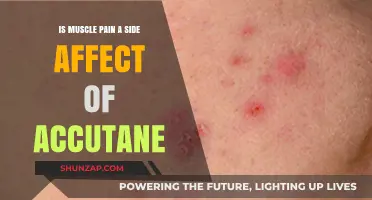 Accutane and Muscle Pain: Understanding Potential Side Effects