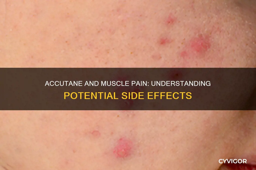is muscle pain a side affect of accutane
