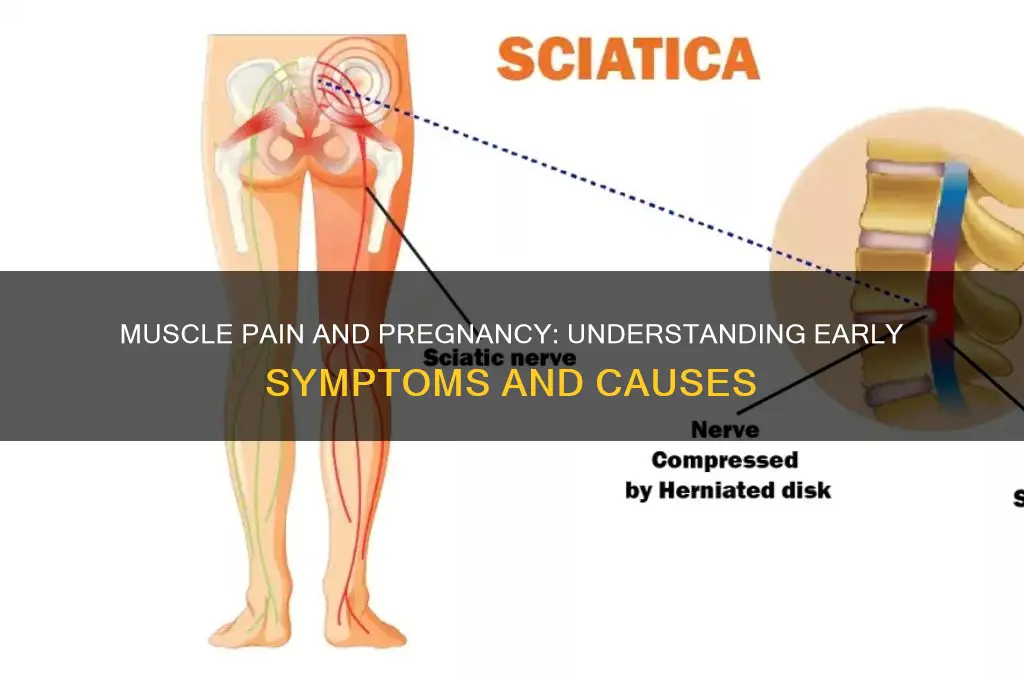 is muscle pain a sign of pregnancy