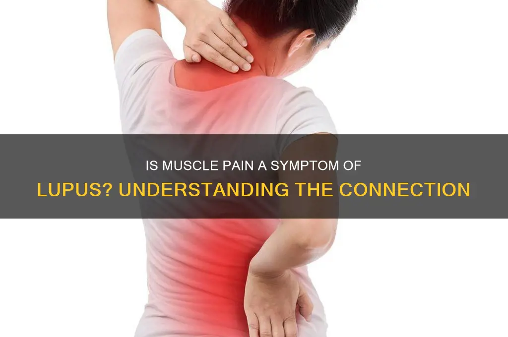 is muscle pain a symptom of lupus