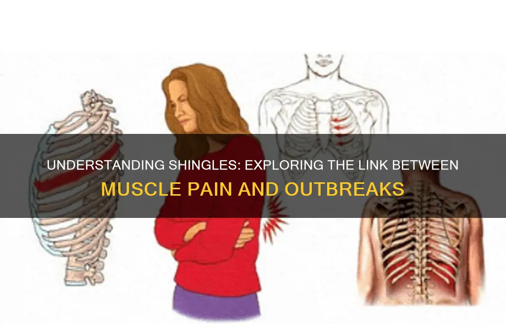 is muscle pain associated with shingles