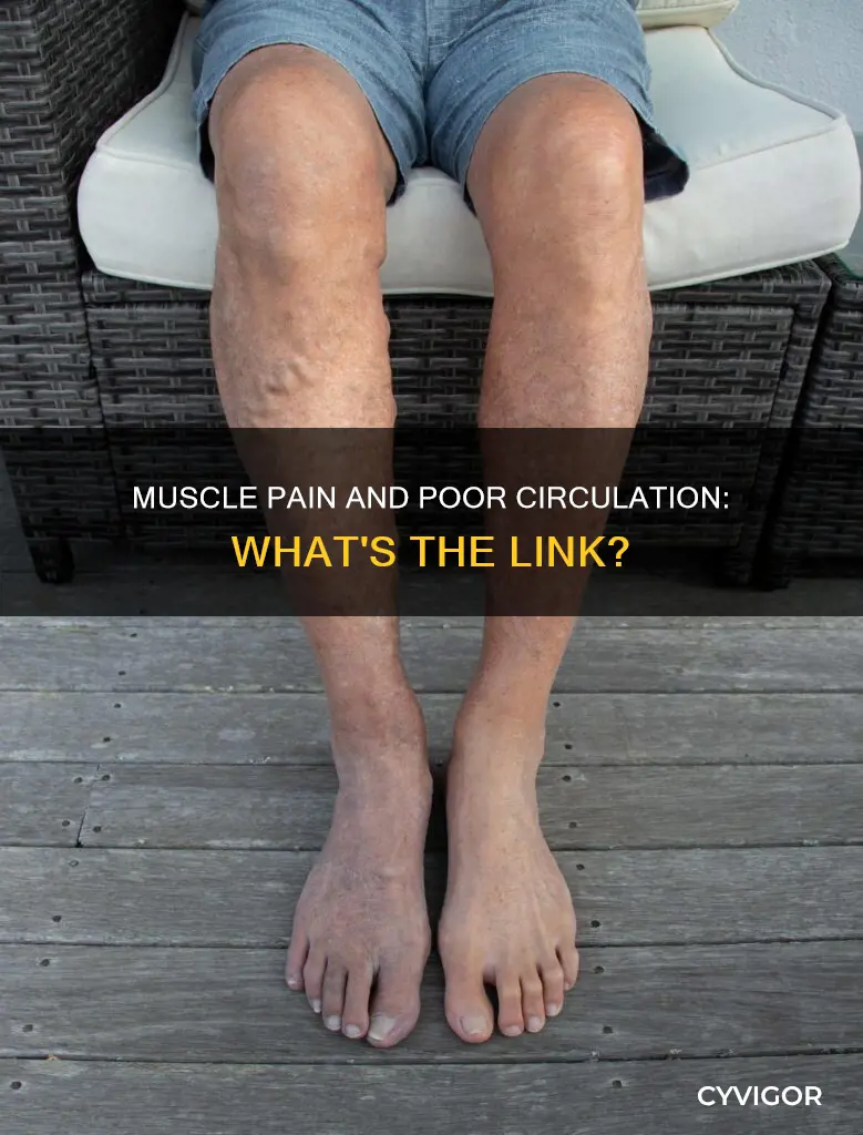 is muscle pain cause by low circulation