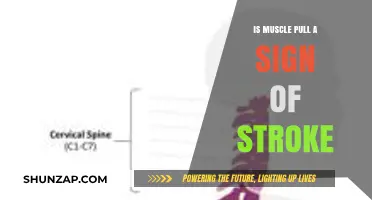 Muscle Pull or Stroke Warning? Recognizing Critical Symptoms Early