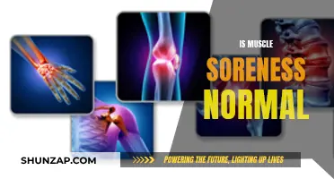 Muscle Soreness: Normal or Not?