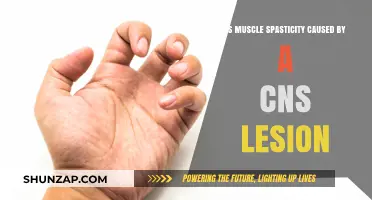 Spasticity and CNS Lesions: Understanding the Link