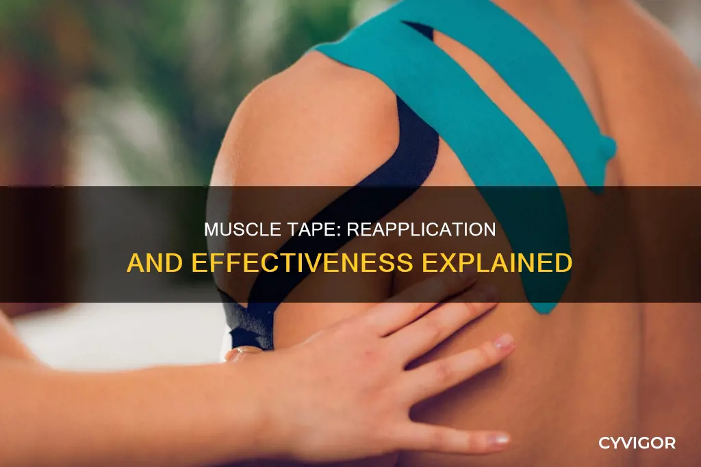 is muscle tape reappliable