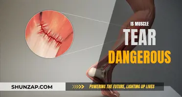 Muscle Tears: Are They Dangerous and How to Treat?