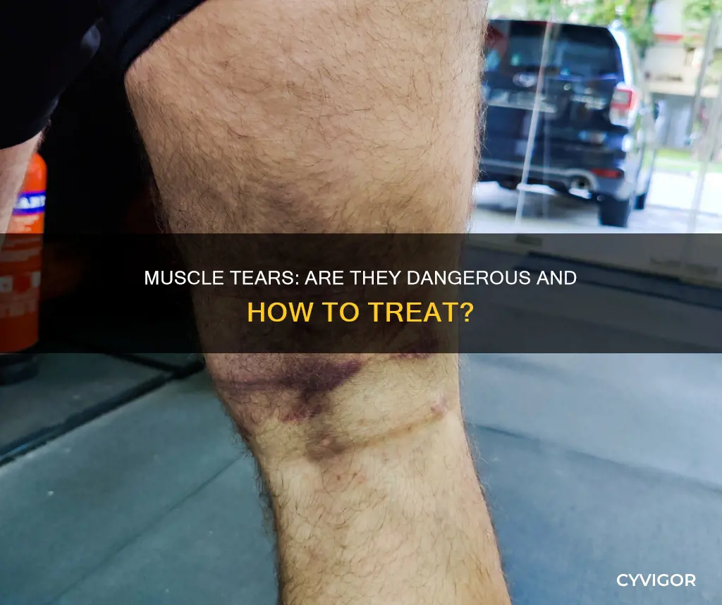 is muscle tear dangerous