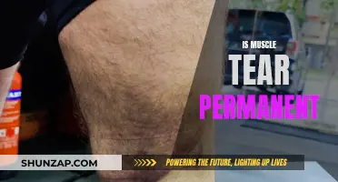 Muscle Tears: Can They Be Healed or Are They Permanent?