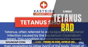 Muscle Tetanus: Harmful or Harmless?