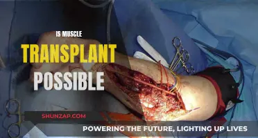 Muscle Transplant: Is It Possible to Relocate Muscles?